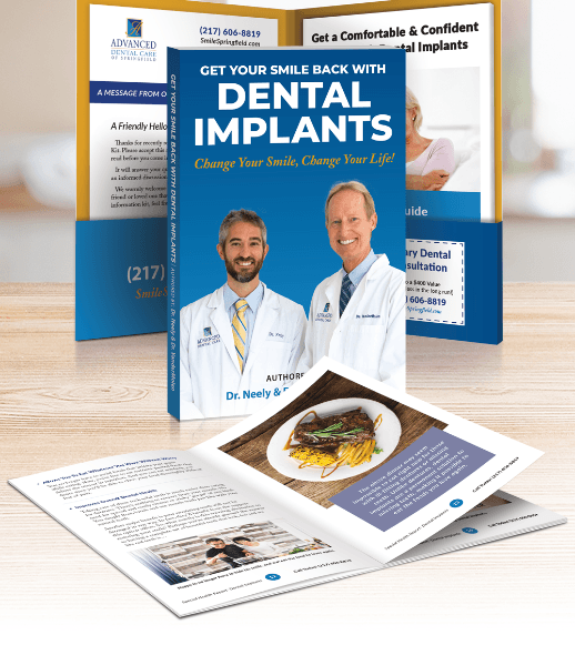 Preview for dental implants book by Springfield dentists