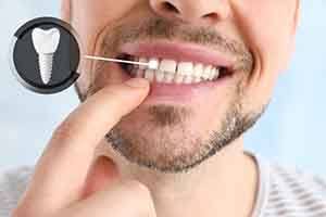 a man pointing at his new dental implant