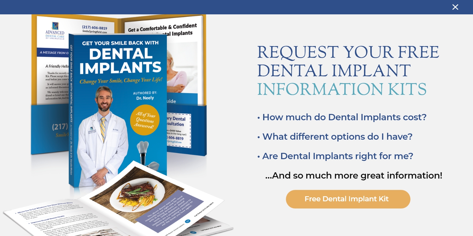 Dental implants book preview